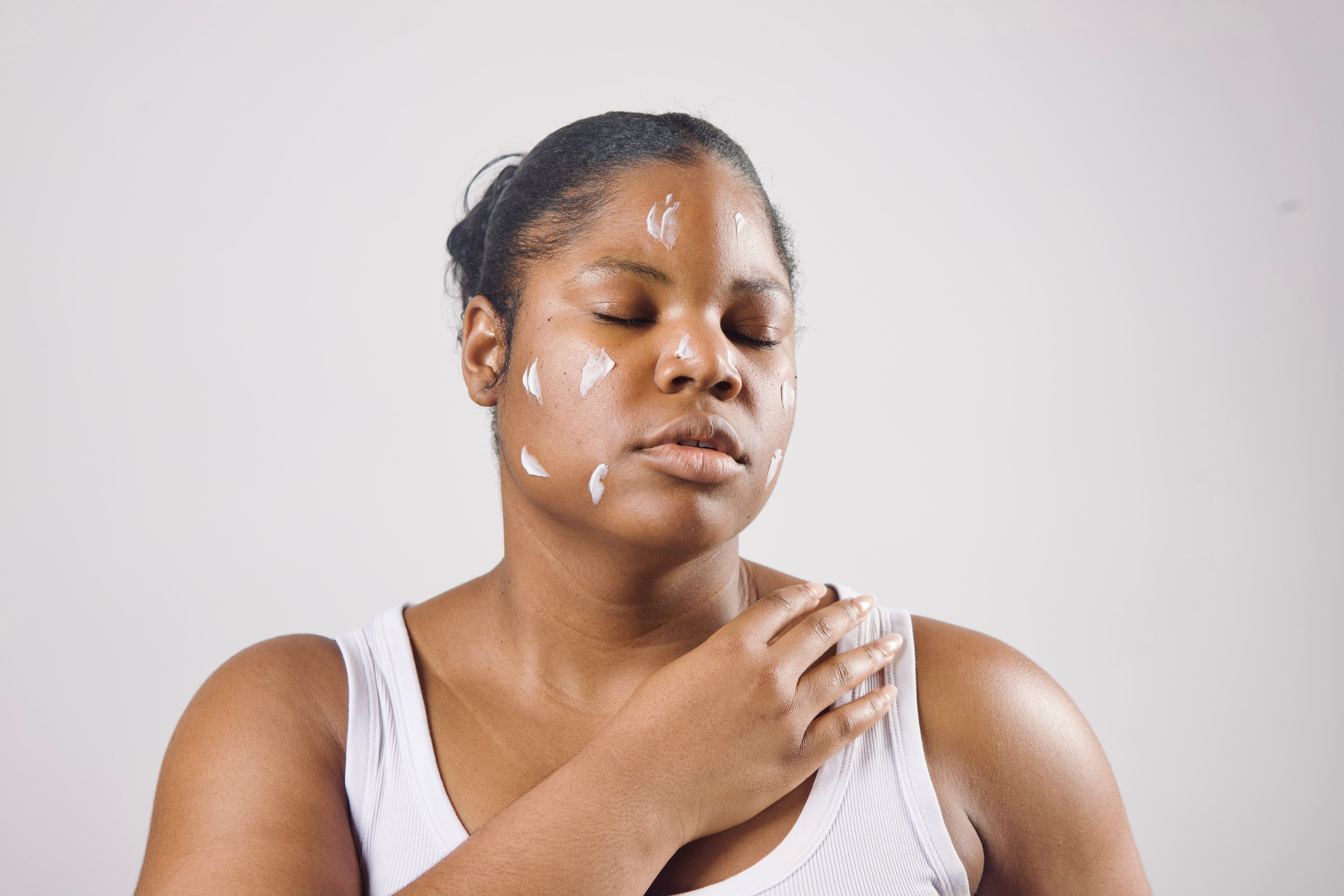 Hyperpigmentation : qu’est-ce que c’est et pourquoi apparaît-elle sur la peau ?